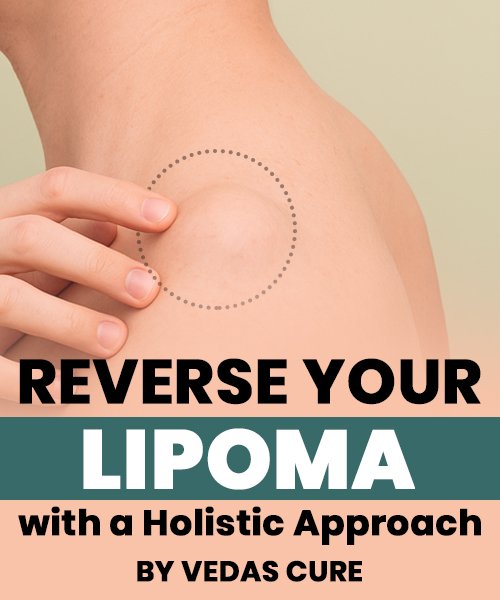 lipoma (3)